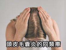 《自然療法與你》- EP803 - 頭皮毛囊炎的同類療法