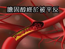 《自然療法與你》- EP787 - 膽固醇終於被平反