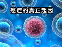 《自然療法與你》- EP791 - 癌症的真正起因