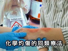 《自然療法與你》- EP815 - 化學灼傷的同類療法