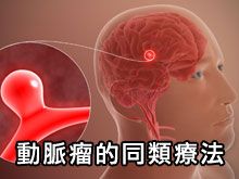 《自然療法與你》- EP799 - 動脈瘤的同類療法