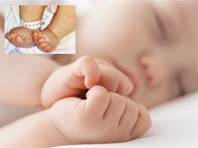 《自然療法與你》- EP513 - 初生嬰兒水腫的同類療劑