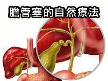 《自然療法與你》- EP792 - 膽管塞的自然療法
