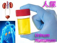 《靈丹妙藥的同類療法》- EP195 - 人尿 Urinum Humanum