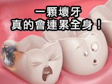 《自然療法與你》- EP784 - 一顆壞牙真的會連累全身！